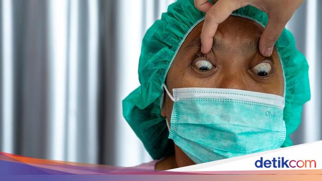 30 Pasien Jalani Operasi Mata Juling Gratis