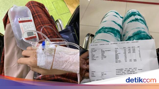 Wanita Jaktim Kena Pneumonia Dikira ‘Masuk Angin’ Biasa, Ini Gejala yang Dikeluhkan