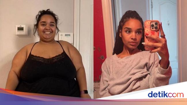 Wanita Ini Sukses Pangkas BB Hingga 109 Kg, Perubahannya Bikin Pangling!